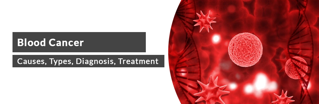 Blood cancer: Causes, Types, Diagnosis, Treatment, Prevention and Cost